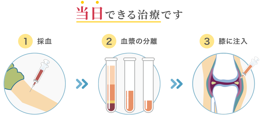 当日できる治療です/①採血→②血漿の分離→③膝に注入